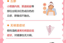染上性疾病有哪些反应，女人得了性疾病有哪些症状
