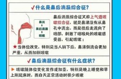 感染新冠鼻涕像水一样流出来（新冠流清水鼻涕要警惕了）