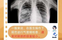 肺炎做气管镜有必要吗，肺炎做气管镜有风险吗