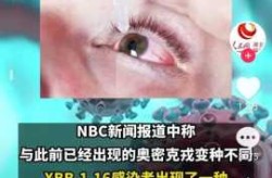 新变异毒株会引发什么症状呢，变异株新冠病毒症状