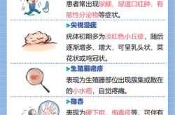 怎样判断自己有性疾病，怎么判断自己有没有得性疾病