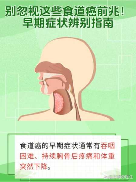 食道癌的早期症状有什么感觉（食道癌吃什么肉最好）