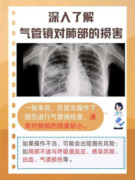 肺炎做气管镜有必要吗,肺炎做气管镜有风险吗